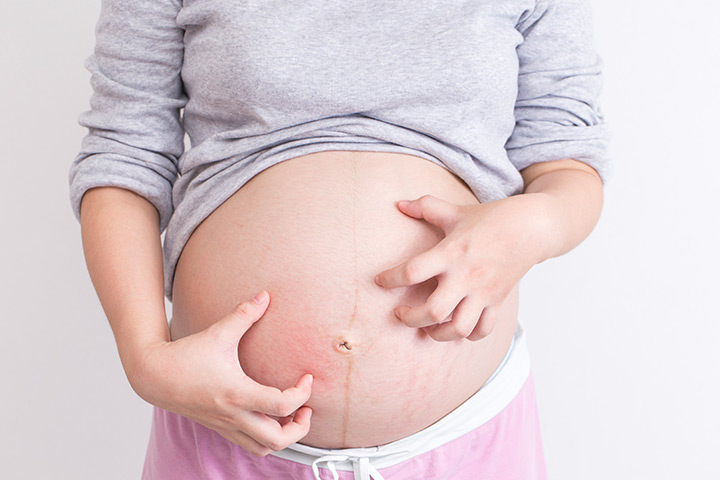 Φαγούρα στην εγκυμοσύνη… χολόσταση κύησης ή απλά ένα ενοχλητικό σύμπτωμα ?